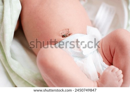 Navel of a newborn, close-up. selective focus Royalty-Free Stock Photo #2450749847