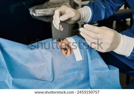 Surgeon wearing mask performing laser vision correction on womans face.