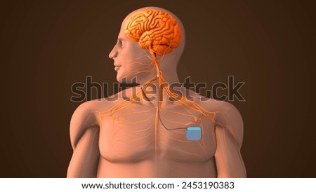Medical treatment with Vigus Nerve Stimulation 3D illustration