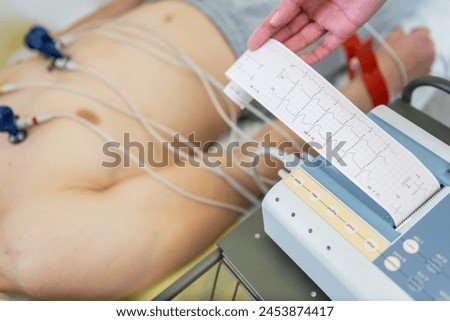A patient undergoing an electrocardiogram test with electrodes attached to the chest, as a healthcare professional examines the ECG readout. Royalty-Free Stock Photo #2453874417