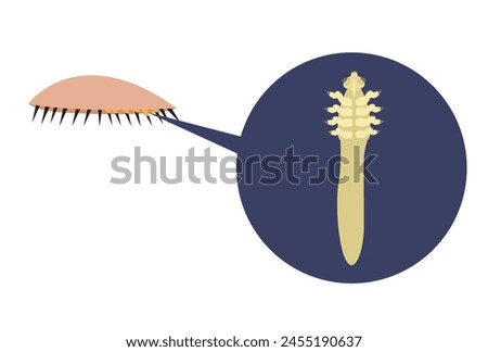 Demodex face mite causes blepharitis or discomfort in the eyelids. Editable Clip Art.