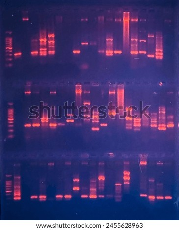 photo of DNA bands in agarose gel as shown under the UV light