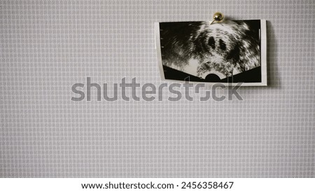 Background containing fetal ultrasound photo