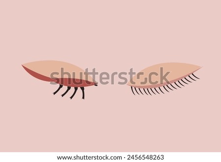 Eye Problem concept. Demodex Face mite infestation or Inflammation. Editable Clip Art.