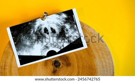 
Background composed of fetal ultrasound