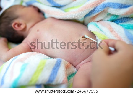 Cleaning umbilical in a newborn baby Royalty-Free Stock Photo #245679595