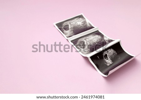 Ultrasound Image, Picture Of 7 Weeks Pregnant Woman With Twins, Embryo On Pink Background. Selective Focus. Space For Text, Mockup. Fetus Development, Pregnancy Health Checking. Maternity, Horizontal.