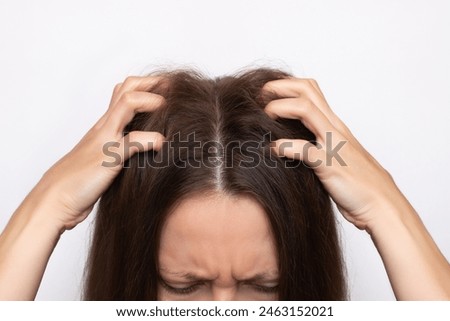 Cropped shot of a young woman scratching her head with her fingers, isolated on a white background. Scalp diseases: fungus, dandruff, rash, psoriasis, seborrhea. Lice. Hair loss. Itching. Close-up