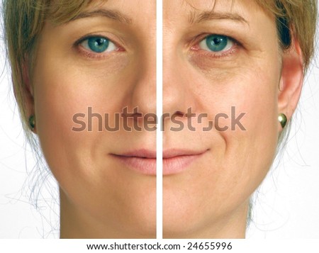 Correction of wrinkles on half face Royalty-Free Stock Photo #24655996