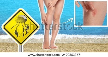 Jellyfish warning sign and injured woman on beach. Banner design