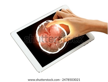 The image shows a finger directing attention to A CT brain scan reveals a subarachnoid hemorrhage isolated on white background. Clipping path.