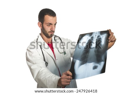 female doctor looking at the x-ray picture of lungs 
