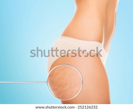 health, people, bodycare and beauty concept - close up of woman buttocks with cellulite and magnifier over blue background Royalty-Free Stock Photo #252126232