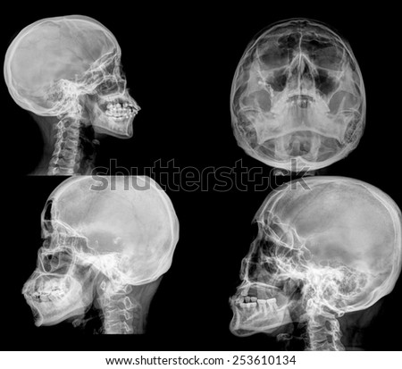 collection of x-ray picture of human skull in natural colors