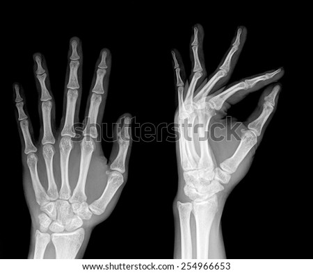 pair of hand on black background, x-ray