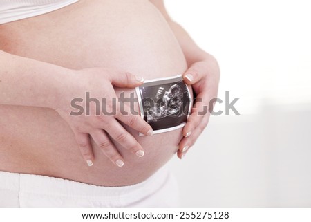 Pregnant woman holding ultrasound scan on her belly