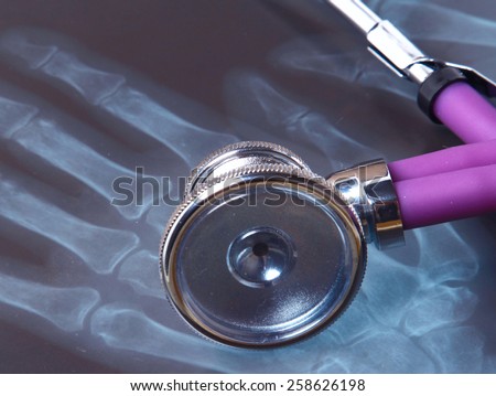 Medical stethoscope on an x-ray picture, closeup