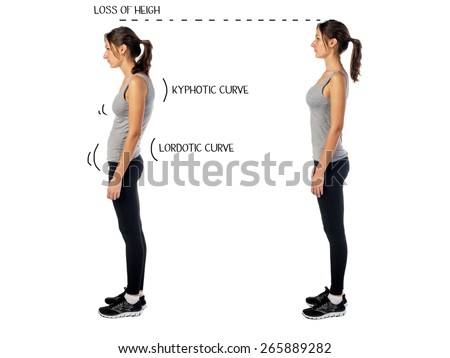 Woman with impaired posture position defect scoliosis and ideal bearing. Royalty-Free Stock Photo #265889282