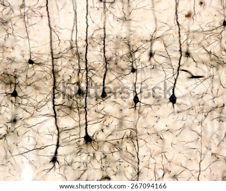 Pyramidal neurons of the cerebral cortex impregnated with the Golgi method. Royalty-Free Stock Photo #267094166