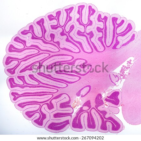 Sagittal section of a young cerebellum showing many ramified cerebellar lamellae. Light micrograph. H&E stain. Royalty-Free Stock Photo #267094202