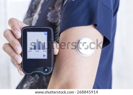 closeup of a hand of a young woman showing a reader after scanning the sensor of the glucose monitoring system beside the sensor placed on her arm - focus on the reader Royalty-Free Stock Photo #268845914