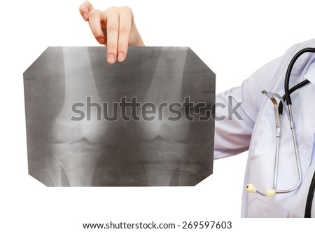 nurse holds X-ray picture with human knee joint isolated on white background