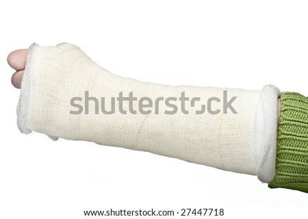 A close up of a broken arm in a plaster cast on a white background. Royalty-Free Stock Photo #27447718