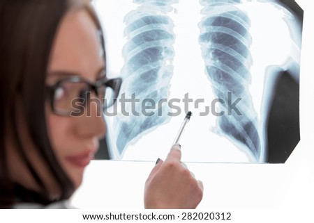 Young female doctor looking at the x-ray picture of lungs on white 