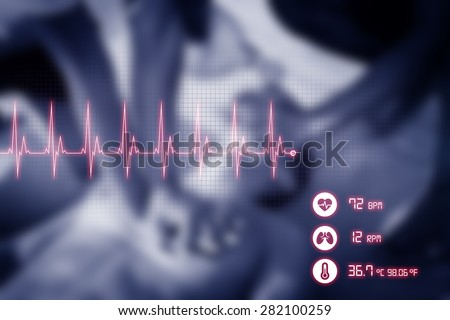 Cardiopulmonary resuscitation blurry scene with cardiogram and medical graphics (CPR). 