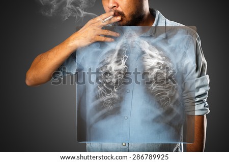 Man smoking with x-ray lung, Isolated on grey background Royalty-Free Stock Photo #286789925