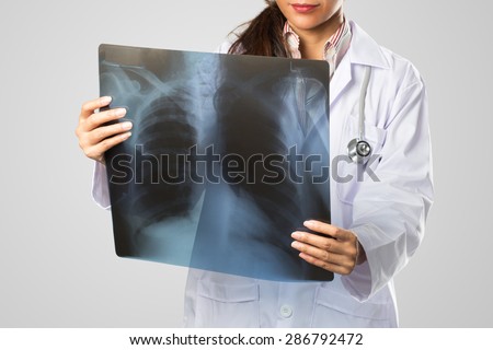 Female doctor looking at the x ray picture of lungs