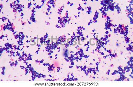 Gram staining, also called Gram's method, is a method of differentiating bacterial species into two large groups (Gram-positive and Gram-negative). Royalty-Free Stock Photo #287276999
