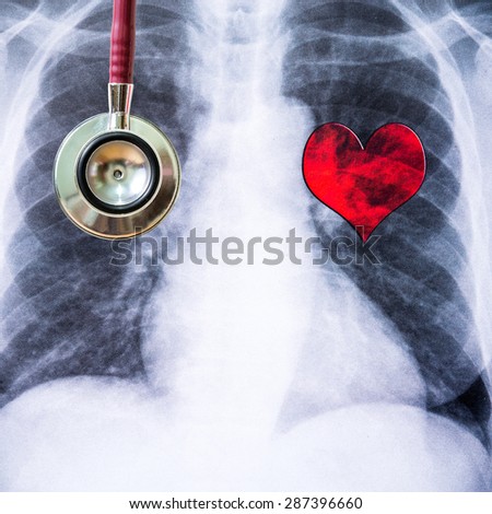 Stethoscope with X-ray film, medical Concept