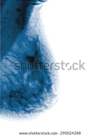 Collection X-ray multiple part of human , painful , isolated on white background