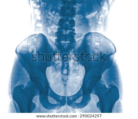 Collection X-ray multiple part of human , painful , isolated on white background