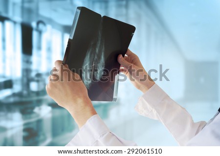 Doctor with Mammography Royalty-Free Stock Photo #292061510