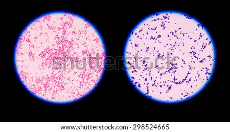 Gram staining, also called Gram's method, is a method of differentiating bacterial species into two large groups (Gram-positive and Gram-negative). Royalty-Free Stock Photo #298524665