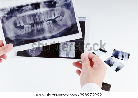 Panoramic dental x-ray image of teeth. Dentist Royalty-Free Stock Photo #298972952
