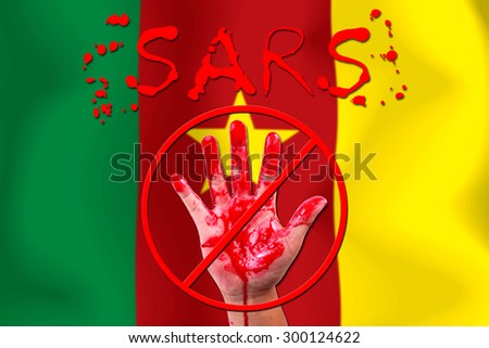 Concept open hand stop Sars (Severe Acute Respiratory Syndrome)  Virus epidemic on flag background.