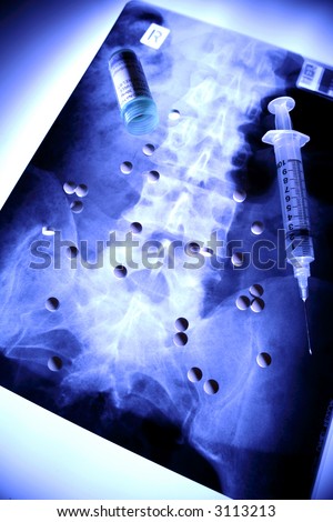 Syringe and pills on X-ray
