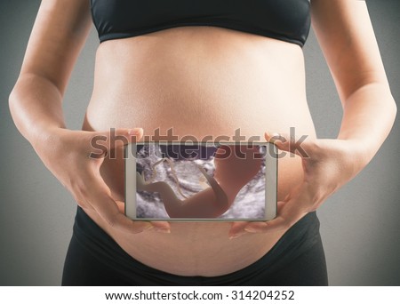 Echography of a baby on a phone Royalty-Free Stock Photo #314204252
