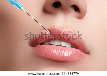 Closeup of beautiful woman gets injection in her lips. Full
lips. Beautiful face and the syringe (plastic surgery and cosmetic injection
concept). Royalty-Free Stock Photo #314688779