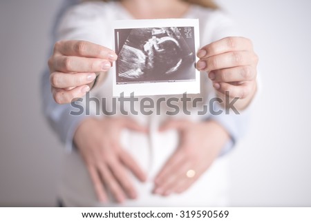 Women holding ultrasound picture of her future daughter in the arms of her husband Royalty-Free Stock Photo #319590569