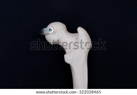 Posterior View of Femoral Head Royalty-Free Stock Photo #322028465