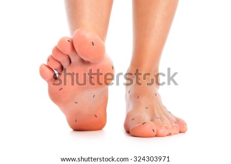 Feet with ants symbolizing numbness over isolated background.