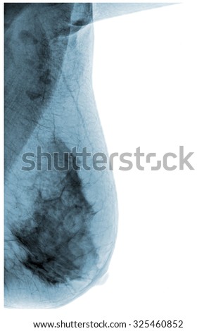 mammography x-ray picture , isolated on white background