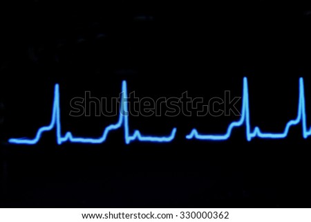 blur image of electrocardiogram on monitor 