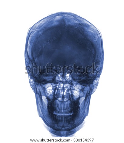 Front face skull x-ray image , isolated on white background