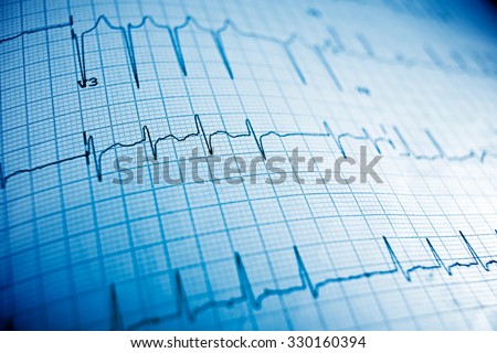 Close up of an electrocardiogram in paper form. Royalty-Free Stock Photo #330160394