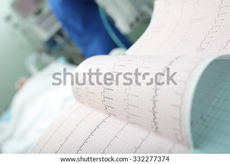 ECG interpretation in the intensive care unit Royalty-Free Stock Photo #332277374